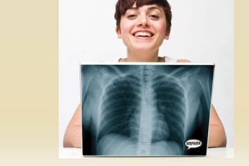 Skin adesive divertenti per notebook