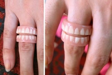 Anello dentiera