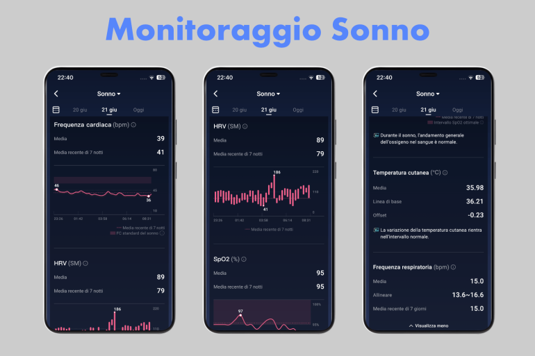 RingConn Gen 2 (Monitoraggio Sonno)